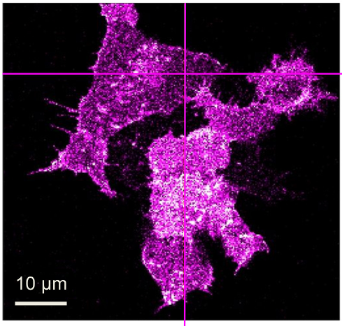 Confocal image of stacks of live HEK293T cells, transiently transfected to express LRP6-mCherry 